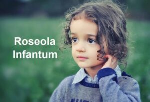 Read more about the article Roseola Infantum (Sixth Disease) Kya Hai – रसोला इन्फैंटम