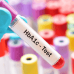 Hemoglobin A1c  Test